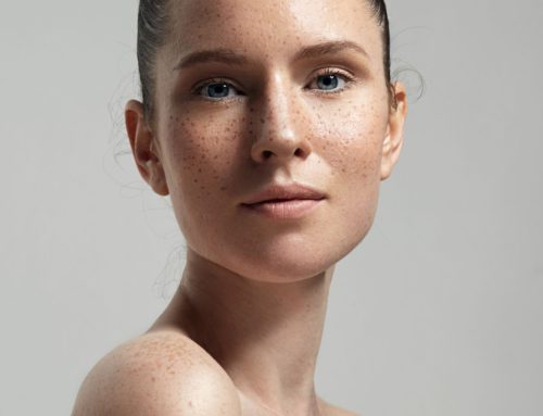 Trends We’re Loving: Fake Freckles