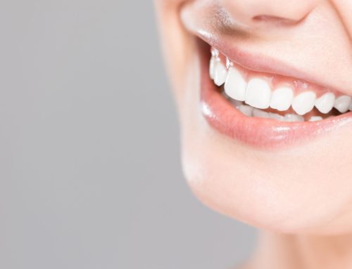 We’ve Tried It, You Should Too: Teeth Whitening